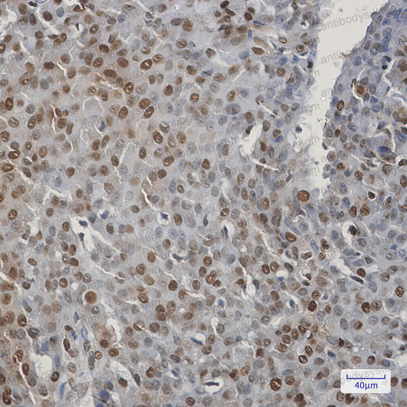 Immunohistochemical for Anti-CIRBP Antibody (R2F13) ?>