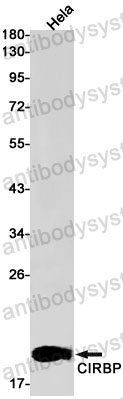 Western blot for Anti-CIRBP Antibody (R2F13) ?>