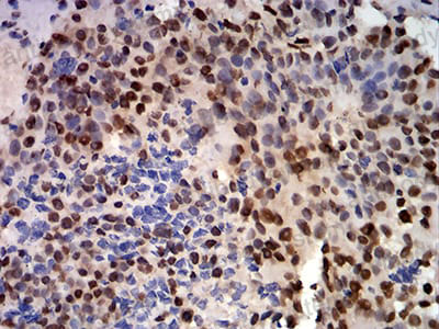 Anti-CIRBP Antibody (R3T04)
