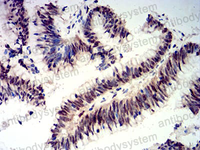 Anti-CIRBP Antibody (R3T05)