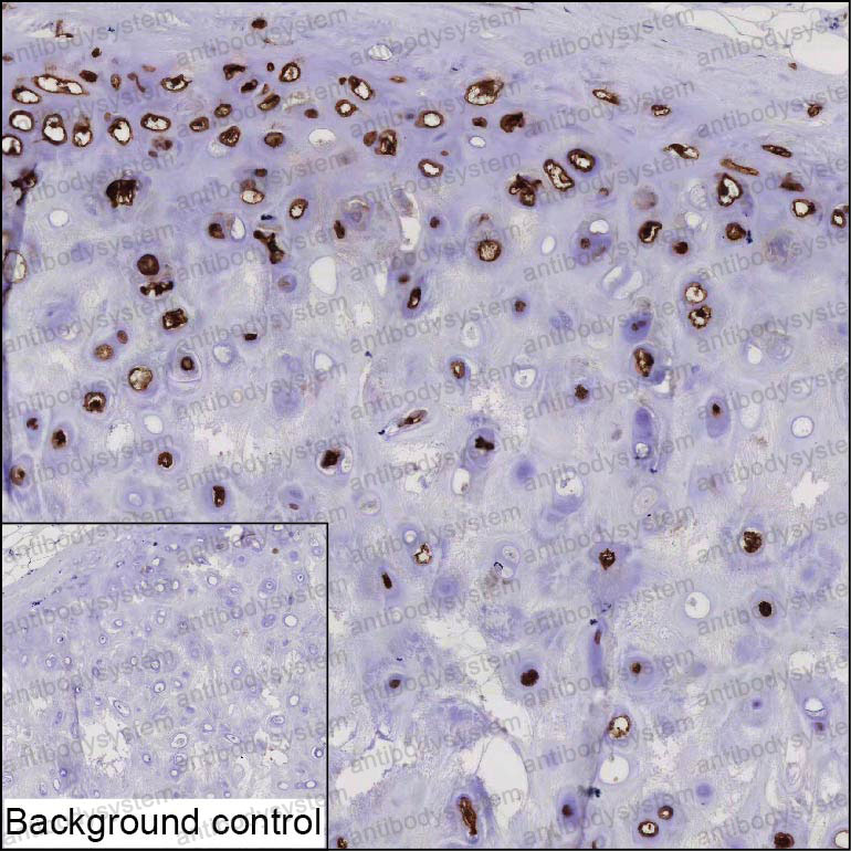 Anti-COL9A2 Antibody (R3T08)