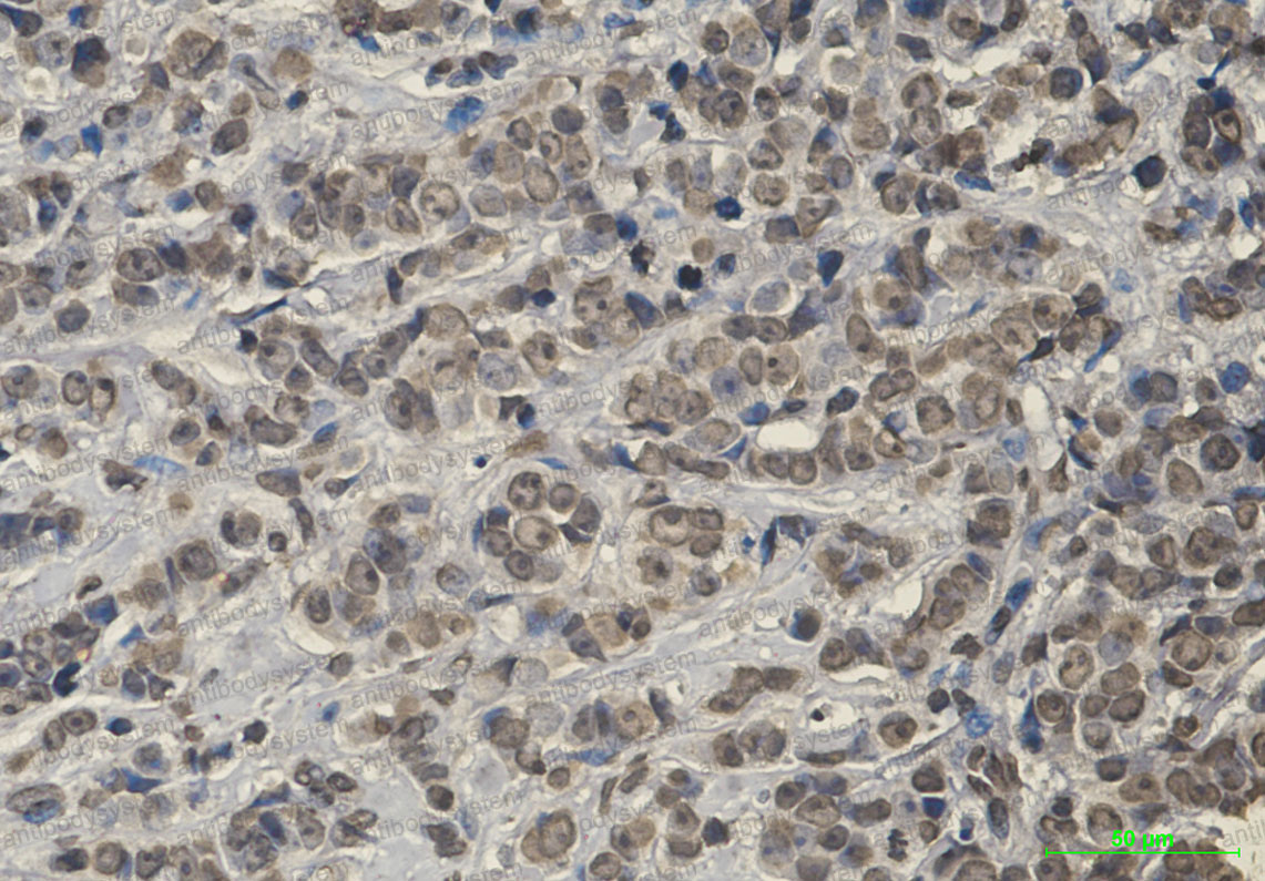 Immunohistochemical for Anti-KEAP1 Antibody (R2F23) ?>