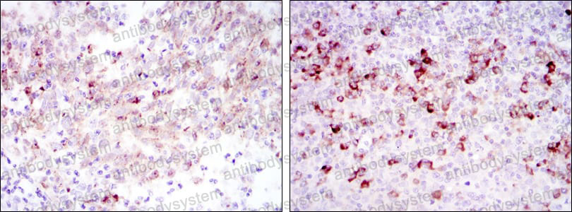 Anti-CTTN Antibody (R3T17)