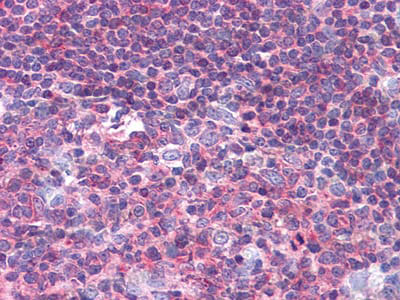 Anti-PTK2B/PYK2 Antibody (R3T20)