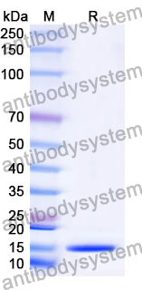 Anti-Human WFDC2/WAP5 Nanobody (SAA1359)