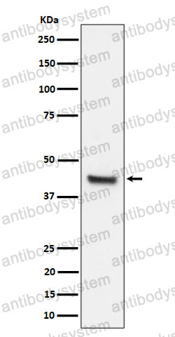 Anti-IL11RA Antibody (R2F60)