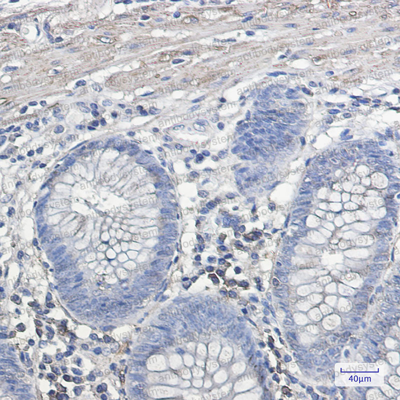 Anti-IL11RA Antibody (R2F61)