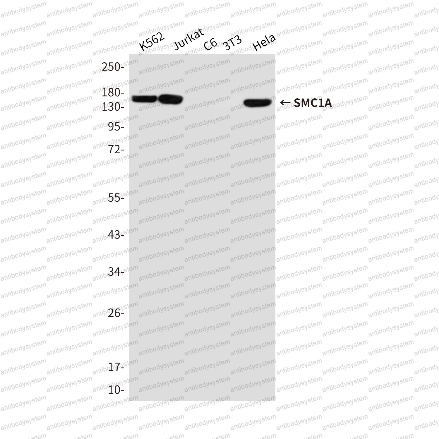 Anti-SMC1A Antibody (R3T30)