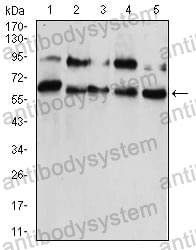 Anti-CBX2 Antibody (R3T31)