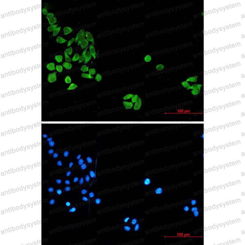 Anti-Cleaved-Caspase 8 Antibody (R3T34)