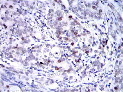 Anti-KIF22 Antibody (R3T35)