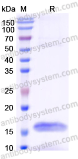 Anti-Human SLC10A1 Nanobody (SAA1095)