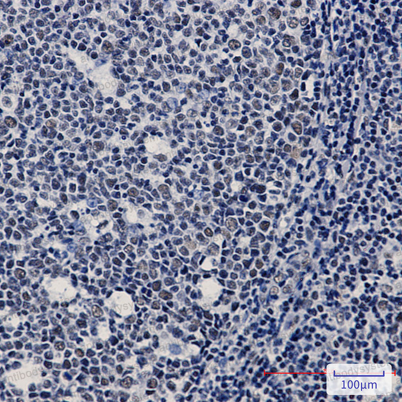Immunohistochemical for Anti-WTAP Antibody (R2F84) ?>