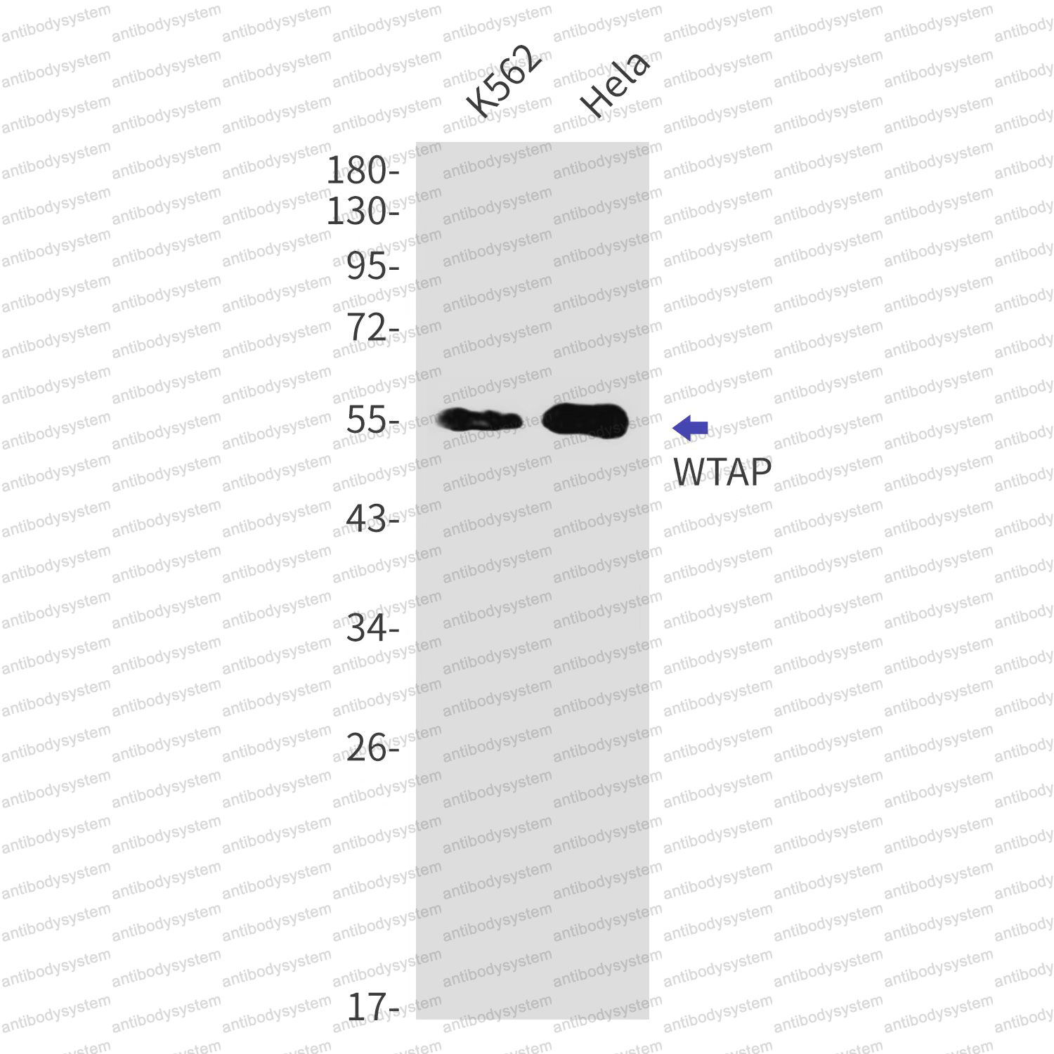 Western blot for Anti-WTAP Antibody (R2F84) ?>