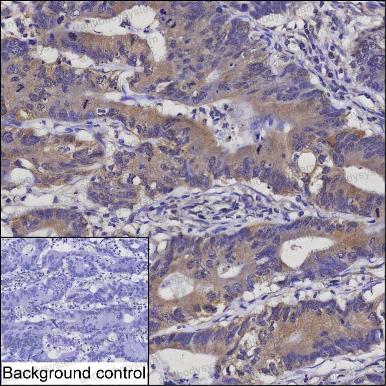 Anti-ABRAXAS2 Antibody (R3T44)