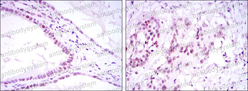 Anti-SUZ12 Antibody (R3T47)