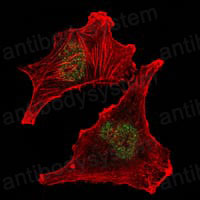 Anti-SUZ12 Antibody (R3T46)