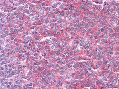 Anti-KARS1/Lysyl-tRNA synthetase Antibody (R3T49)