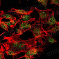 Anti-SETDB1 Antibody (R3T51)