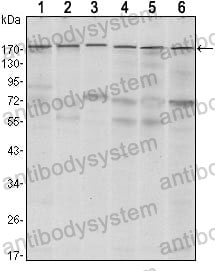 Anti-SETDB1 Antibody (R3T50)