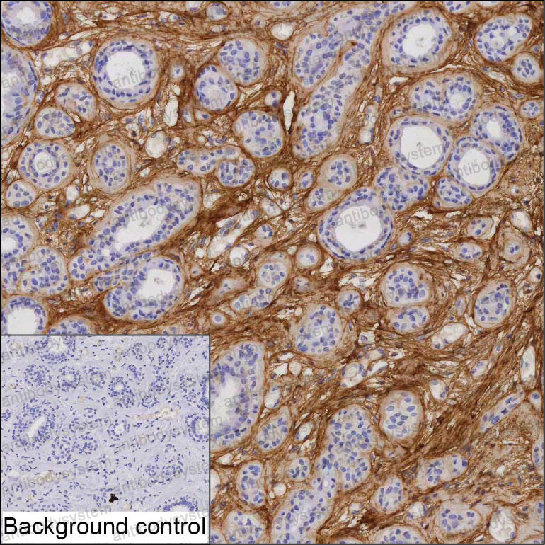 Anti-POSTN/OSF-2 Antibody (R3T52)