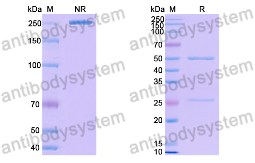 Anti-Human RAGE Antibody (XT-M4)