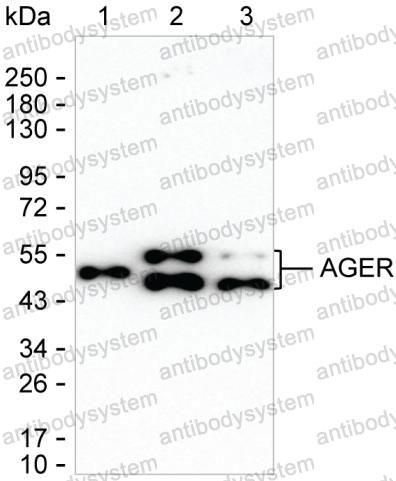 Anti-RAGE/AGER Antibody (R3T53)