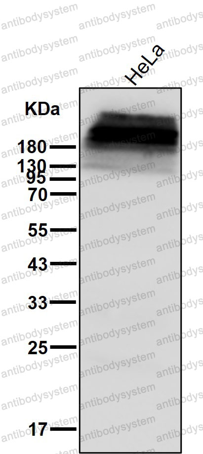Anti-PLEC/Plectin Antibody (R1A57)