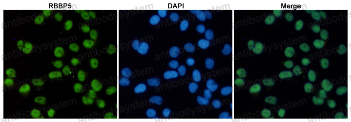 Anti-RBBP5 Antibody (R3T62)
