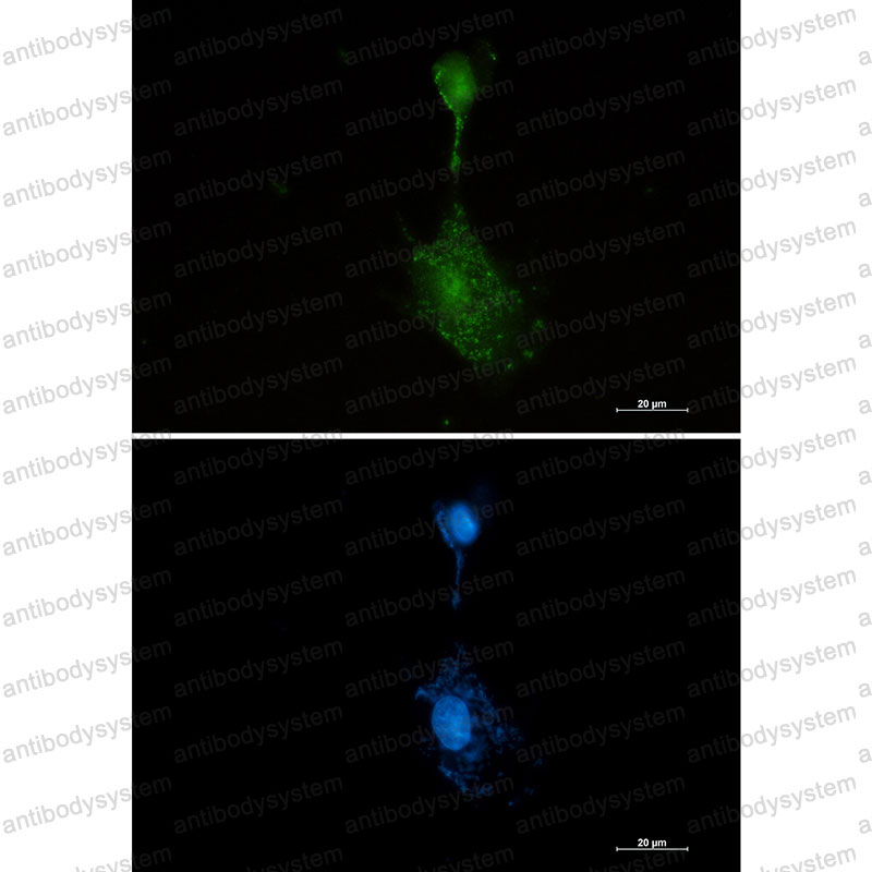 Anti-RPS6KA2 Antibody (R2G25)