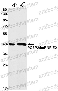 Anti-PCBP2 Antibody (R2G28)