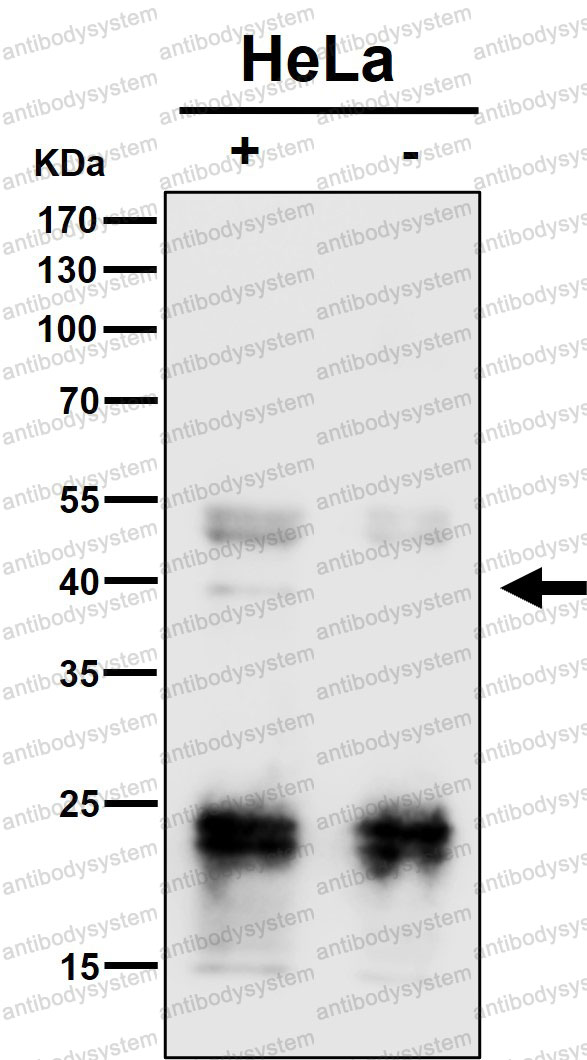Anti-PCBP2 Antibody (R2G27)