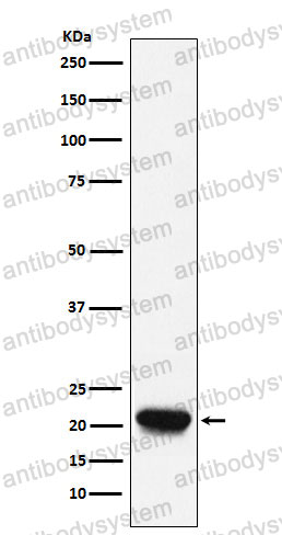 Anti-RHEB Antibody (R2G29)