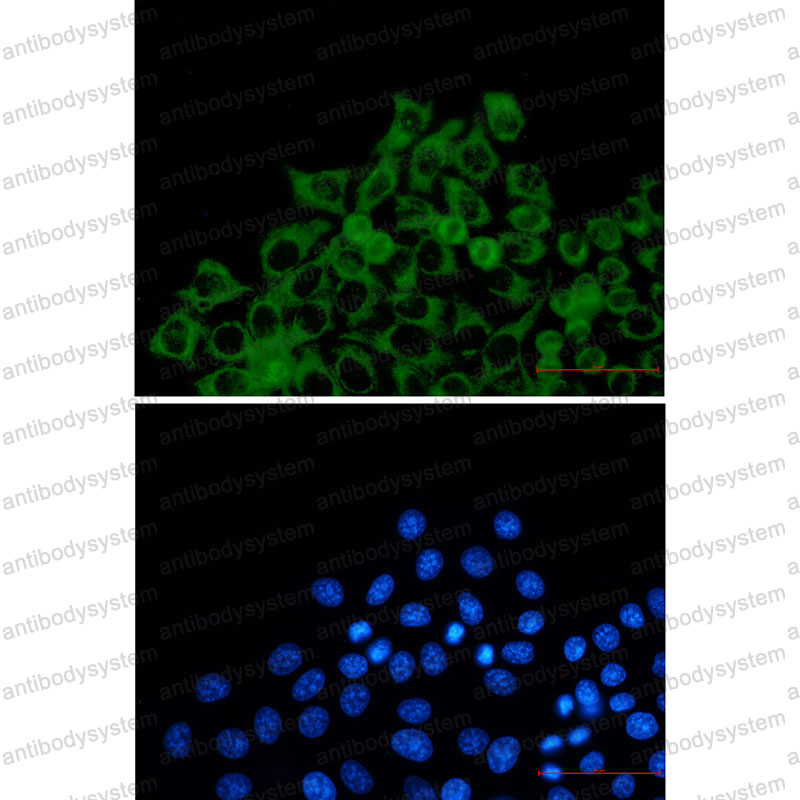 Anti-TOMM20 Antibody (R2G30)