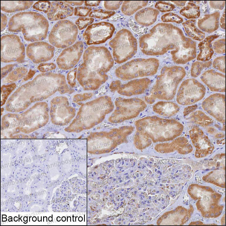Anti-TOMM20 Antibody (R3T69)