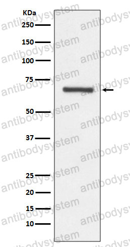 Anti-ANGPT1 Antibody (R2G31)