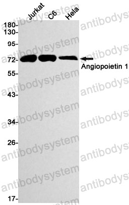 Anti-ANGPT1 Antibody (R2G32)