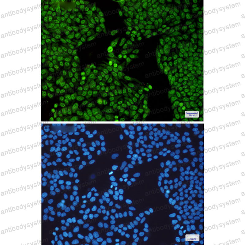 Anti-SF3B3 Antibody (R2G34)