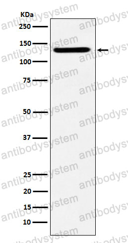 Anti-SF3B3 Antibody (R2G33)