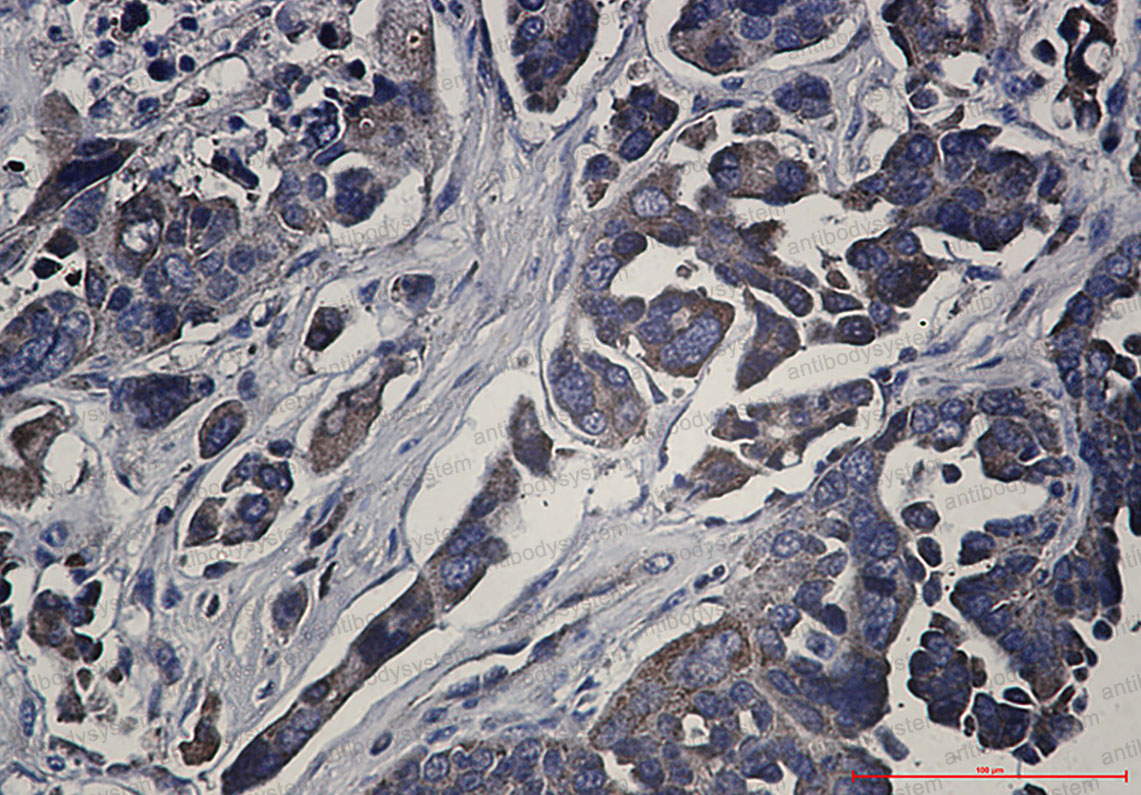 Anti-RPS6KA1 Antibody (R2G37)