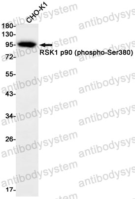 Anti-Phospho-RPS6KA1/RSK1 p90 (Ser380) Antibody (R2G36)