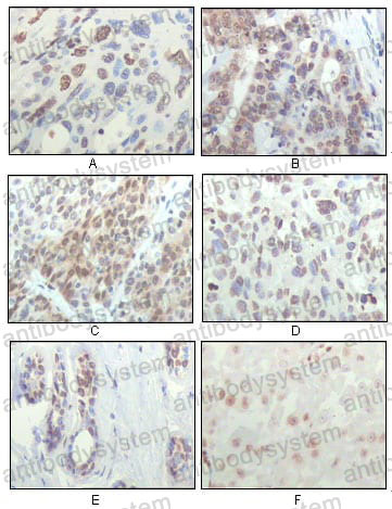 Anti-RPS6KA1 Antibody (R3T77)