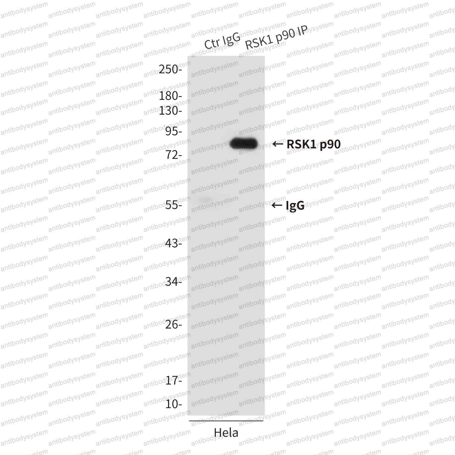 Anti-RPS6KA1 Antibody (R3T78)