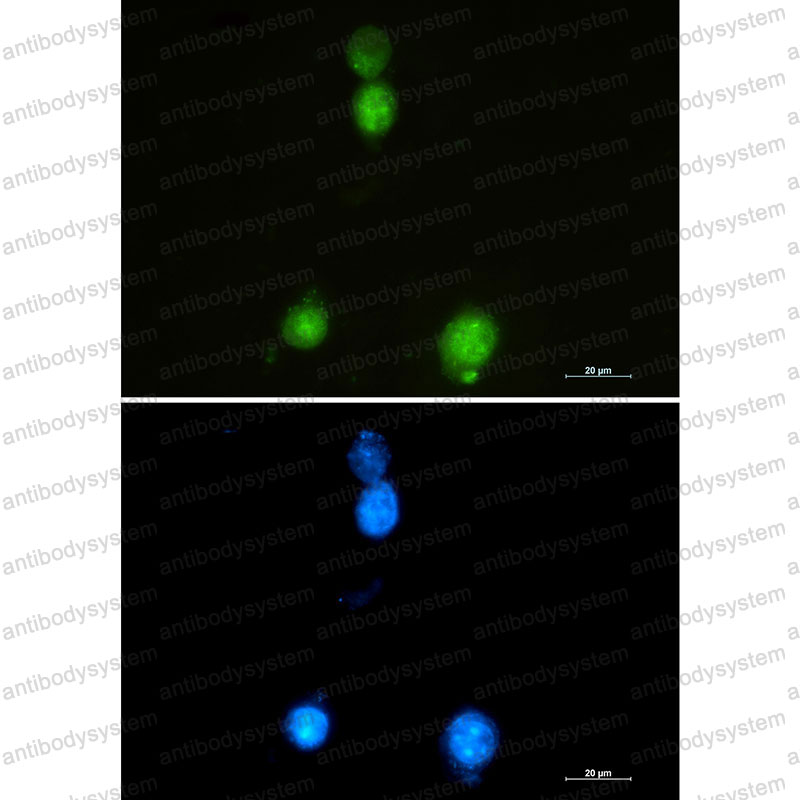 Anti-SAFB Antibody (R2G39)