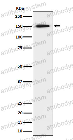 Anti-SAFB Antibody (R2G38)