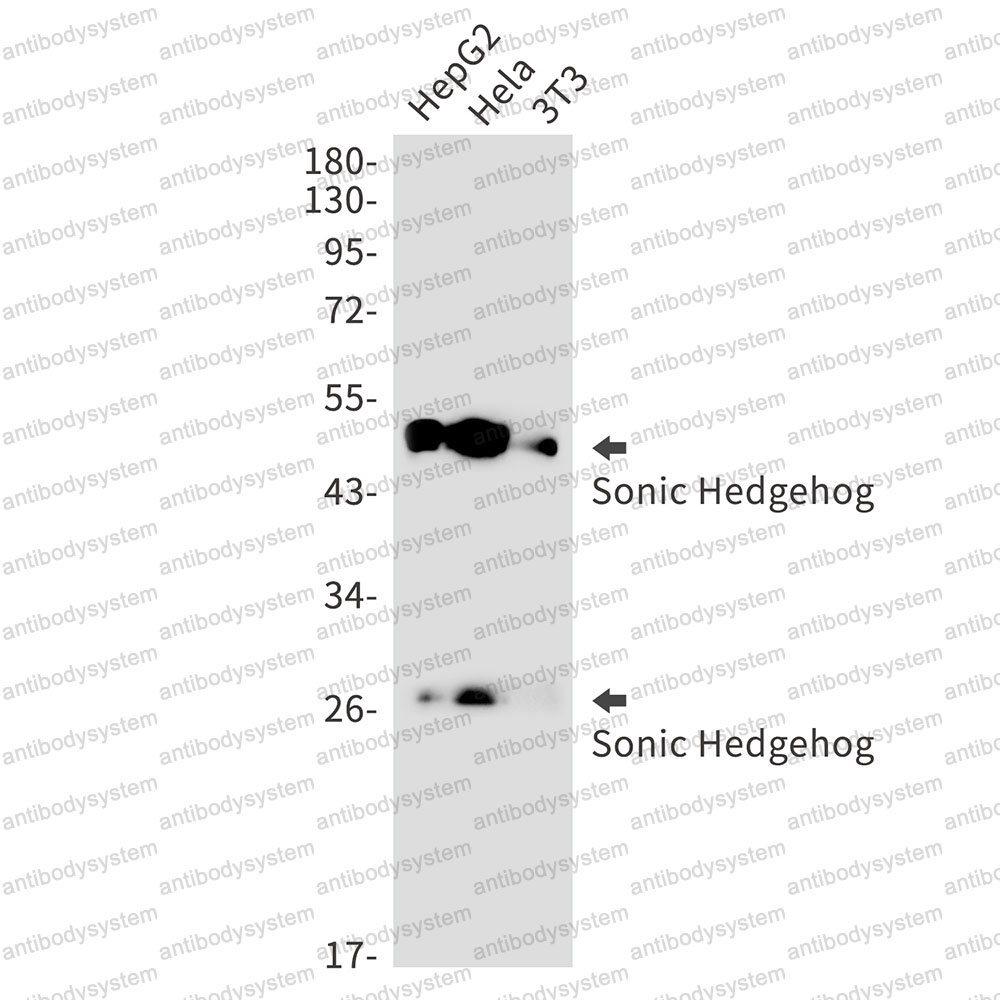 Anti-SHH Antibody (R2G41)