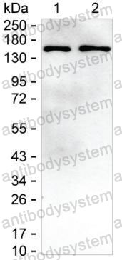 Anti-SKIV2L Antibody (R3T81)