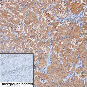 Anti-SKIV2L Antibody (R3T80)