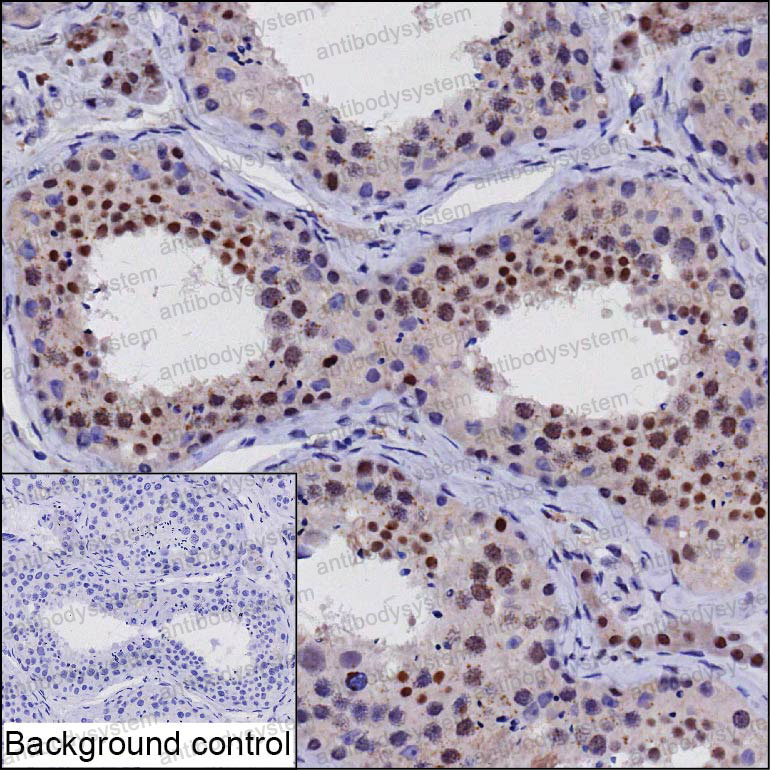 Anti-SURF2 Antibody (R3T84)