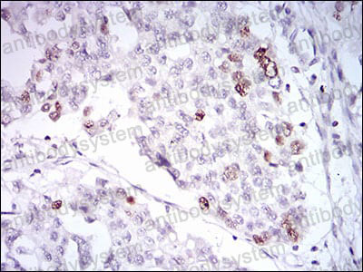 Anti-TERF2 Antibody (R3T85)